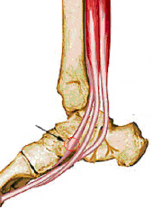 tibiales posterior